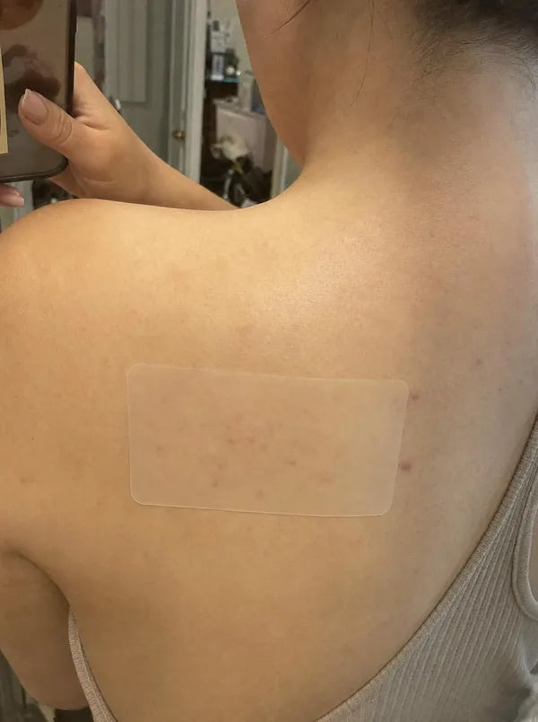 Customer photo of a patch applied to an upper back